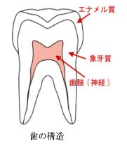 虫歯の進行