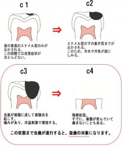 mushiba_img002