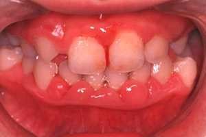 oral-health_img001