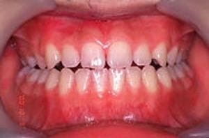oral-health_img002