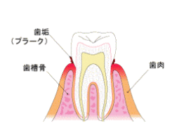 oral-health_img003