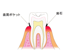 oral-health_img004