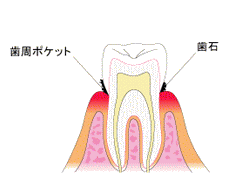 軽度